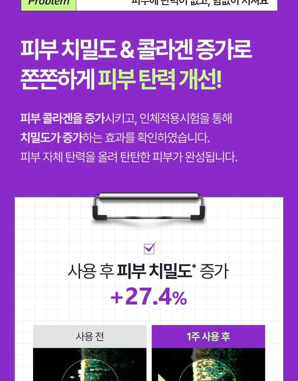 [탄력콜라겐UP/1+1] 차앤박 더마앤서 액티브 부스트 PDRN 앰플 30ml 더블기획 상세페이지 7